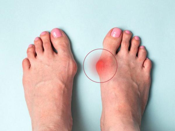 جدی نگرفتن تغییر شکل ساختار پا چه خطراتی دارد؟